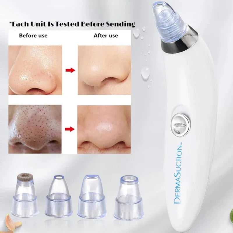 5-in-1 Blackhead remover, blackhead remover machine, derma suction, pimple acne remover