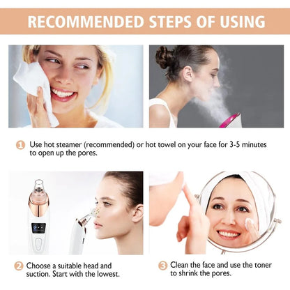 5-in-1 Blackhead remover, blackhead remover machine, derma suction, pimple acne remover
