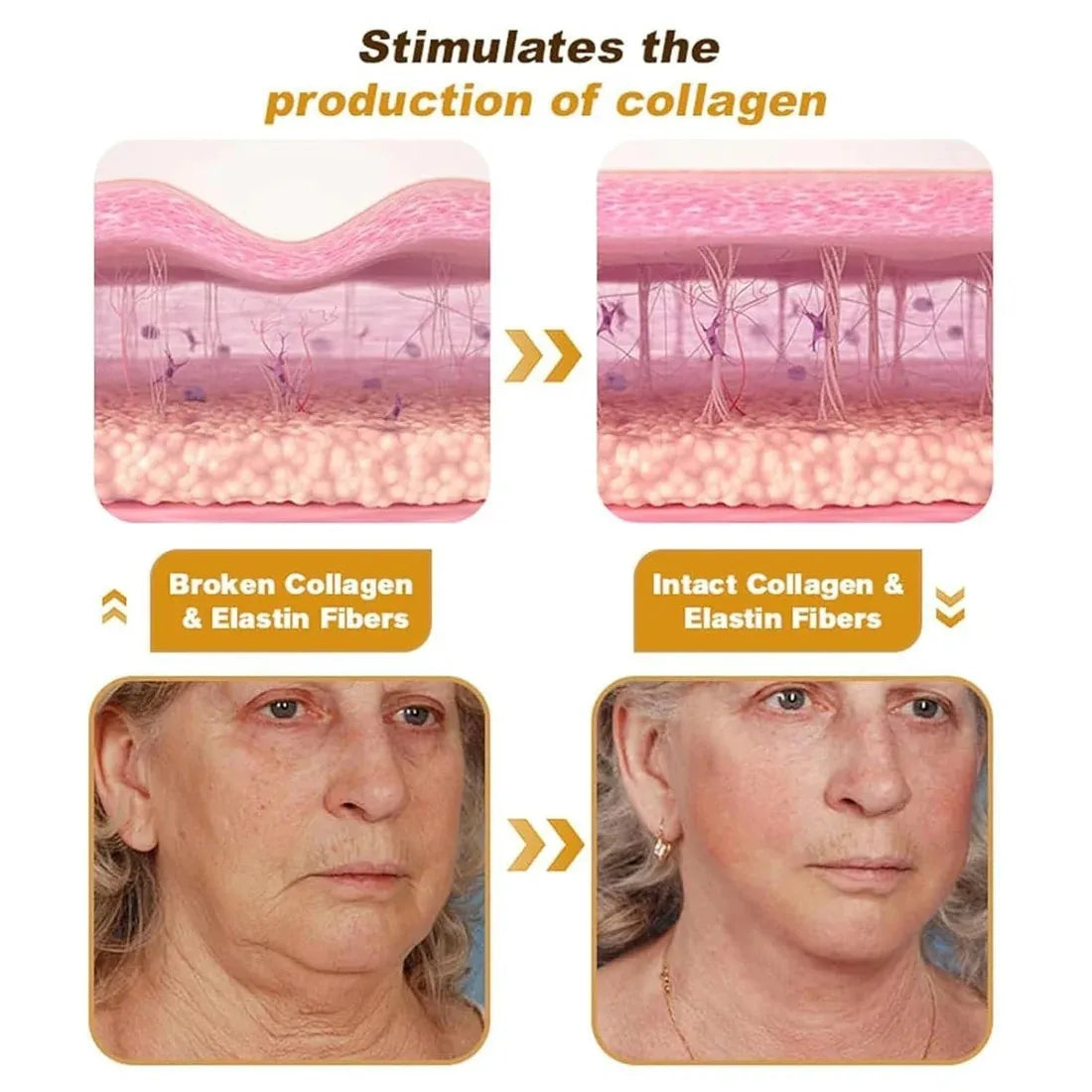 Botox Bee Venom Wrinkle Cream – Anti-Aging & Collagen Boost – 20g