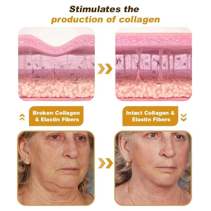 Botox Bee Venom Wrinkle Cream – Anti-Aging & Collagen Boost – 20g